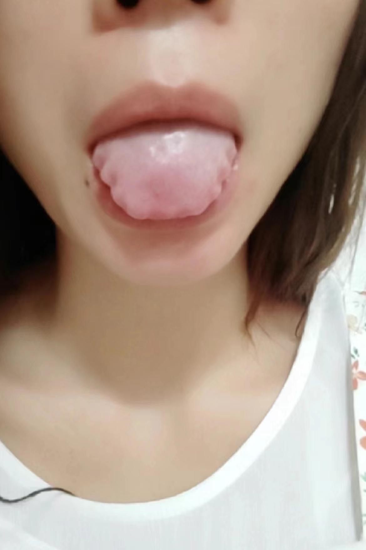 怎么补都是瞎折腾！你看着是湿气重？看着是脾虚？那就大错特错了[我想静静][我想静