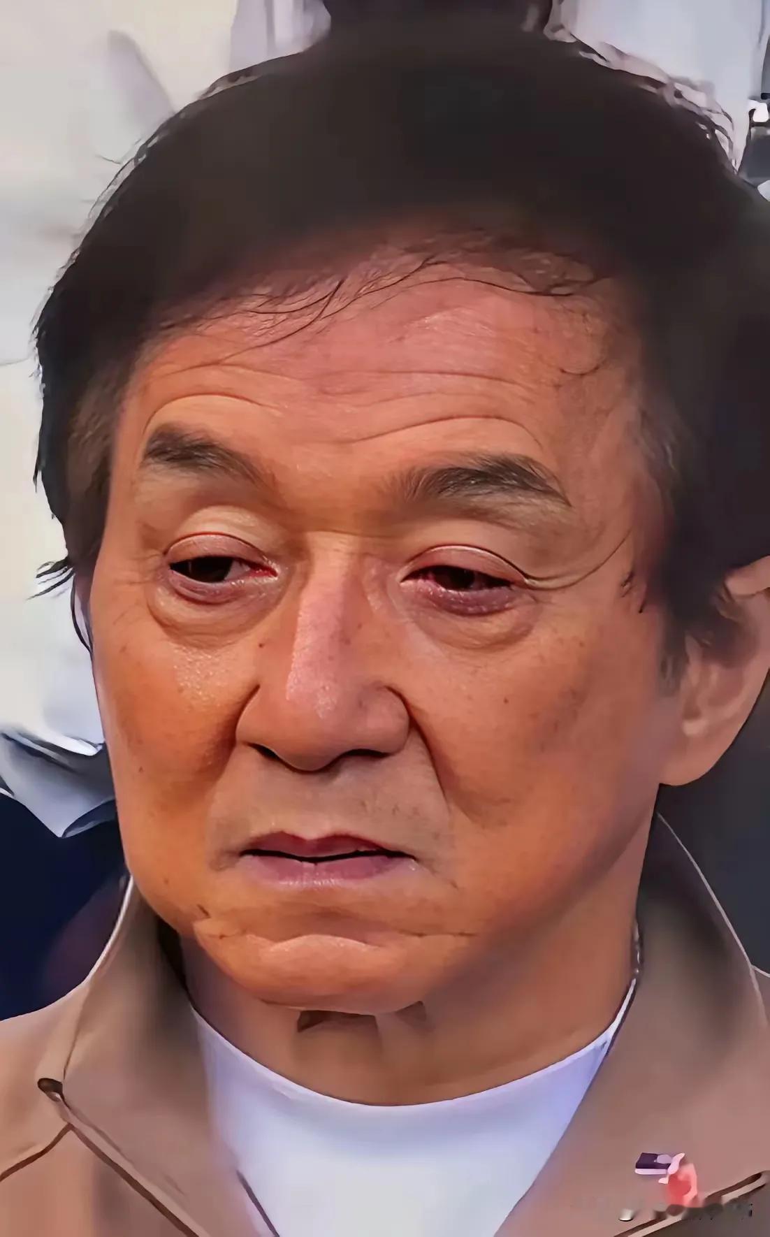 明星那么有钱还是逃不脱自然规律的生老病死！
   就说生病这事，按理说像李咏这样