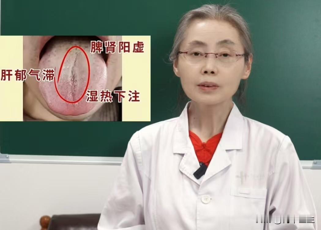 这种舌象，听我句劝，不要上来就补肾了，等脾好健运，肝气舒畅，无痰湿之邪了，再去补
