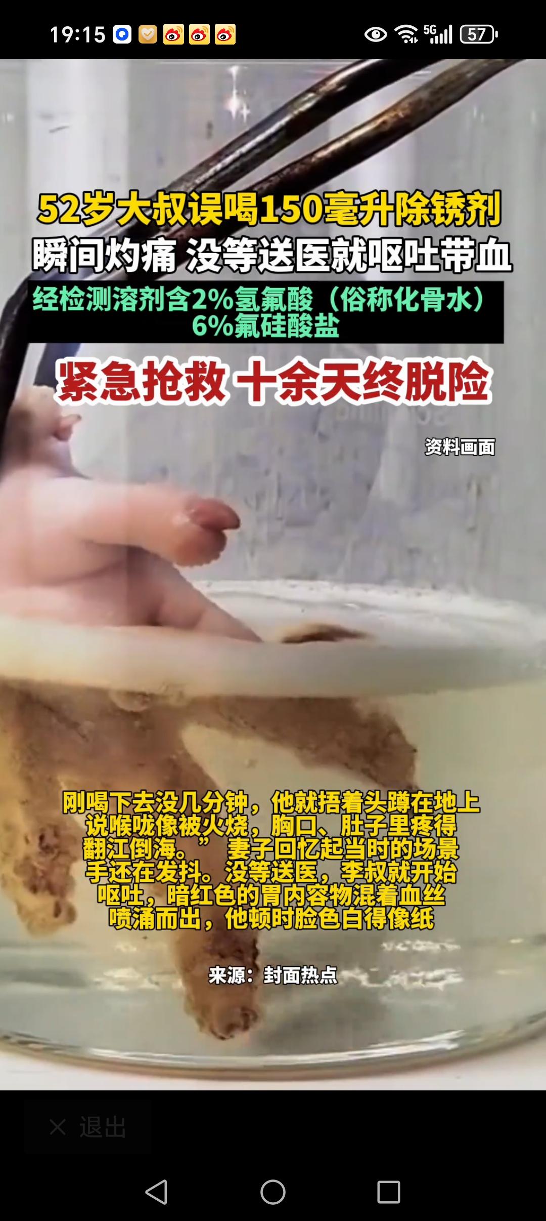 惊险一刻啊！52岁大叔误把半瓶“化骨水”当成饮料喝下肚。

9月26日，52岁的