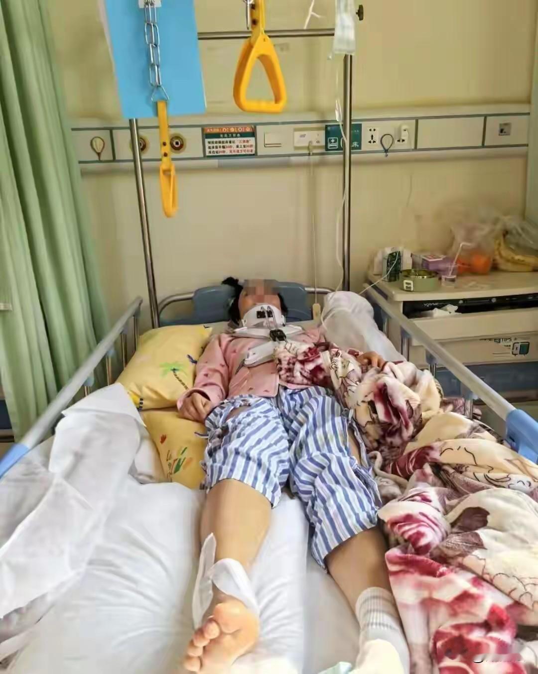 十几秒从4楼冲到28楼！贵州一女子乘电梯遭冲顶重伤，三次调解赔偿仍没着落。
 