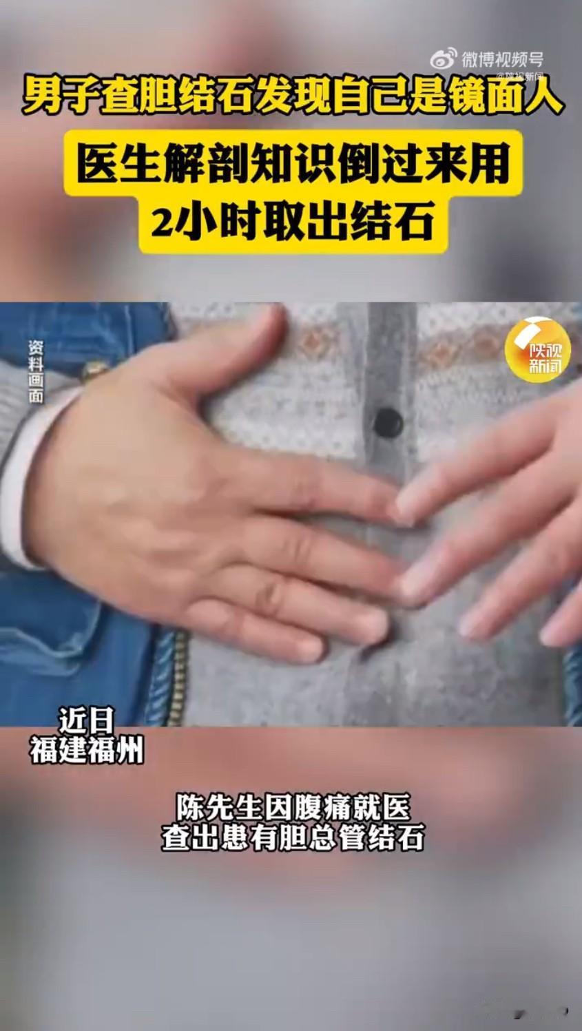 男子查胆结石竟发现是“镜面人”！医生反向手术取石，百万分之一概率太绝！

福建陈
