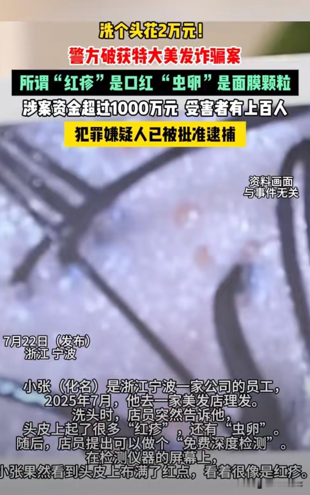 你敢信，洗个头花6万多！浙江宁波，小张去理发店洗头，店员说免费送他一次头皮检测。