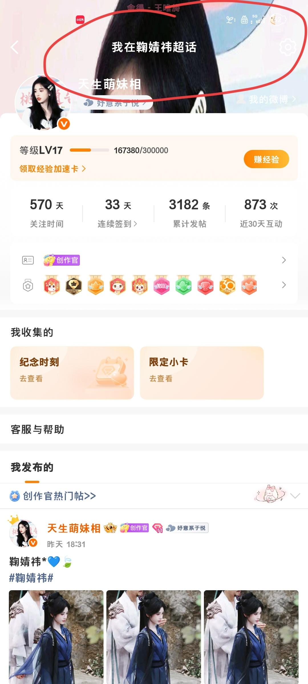 ？？大眼是真有恋丑癖啊 怎么丑怎么改？[闭嘴] ​​​
