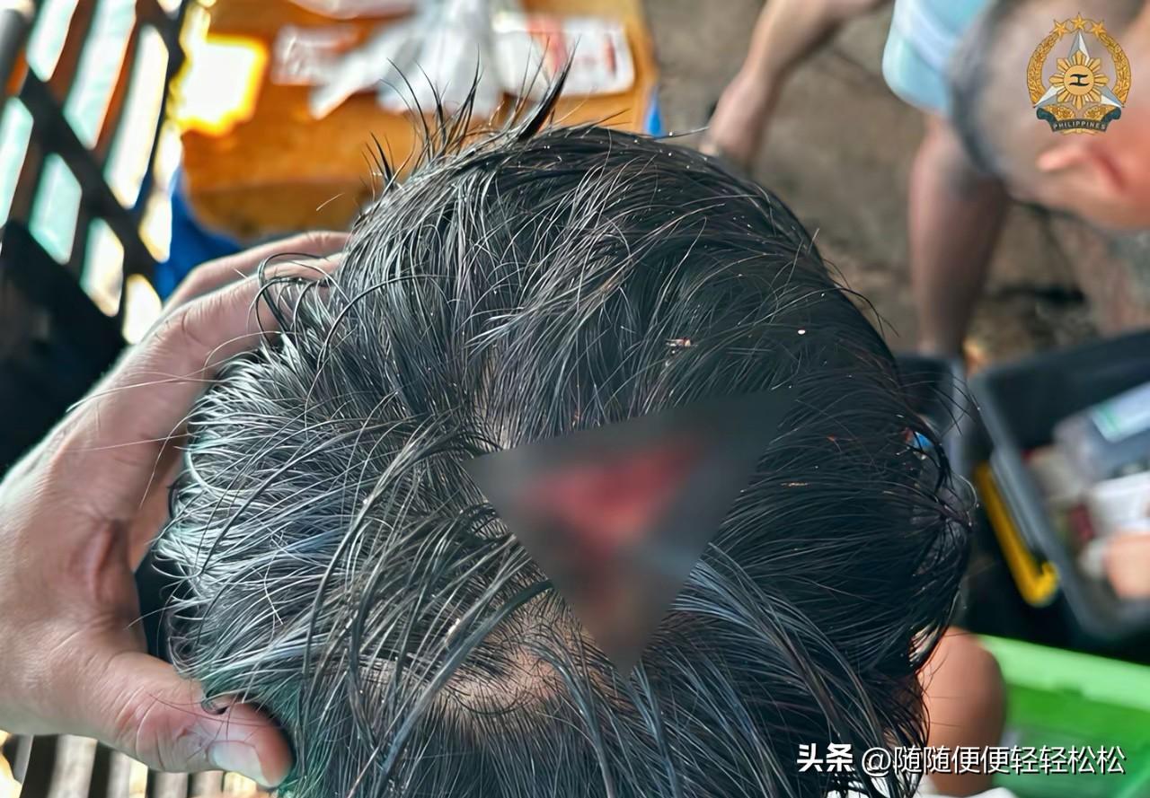 7月20日，菲律宾军方召开发布会称，中国海警使用木棍殴打菲方人员，并造成其“重伤