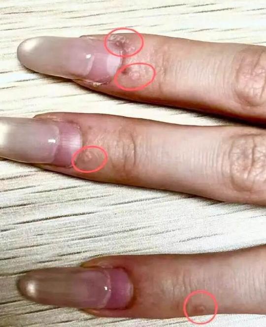 “太吓人了！”5月9日，浙江杭州一则新闻刷爆社交平台，爱做美甲的网友看完纷纷直呼