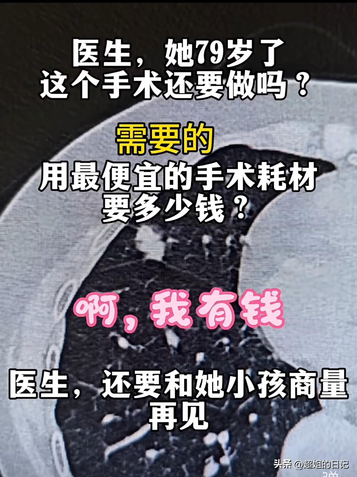 一位79岁的老太太查出肺结节，医生建议手术。孙子询问医生：“手术最便宜的耗材要多
