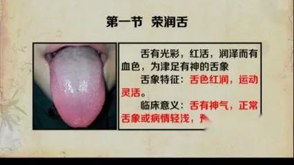 舌头的神态很关键，它代表了你的身体。
舌神，通俗讲就是舌有没有活力。有神的舌应该