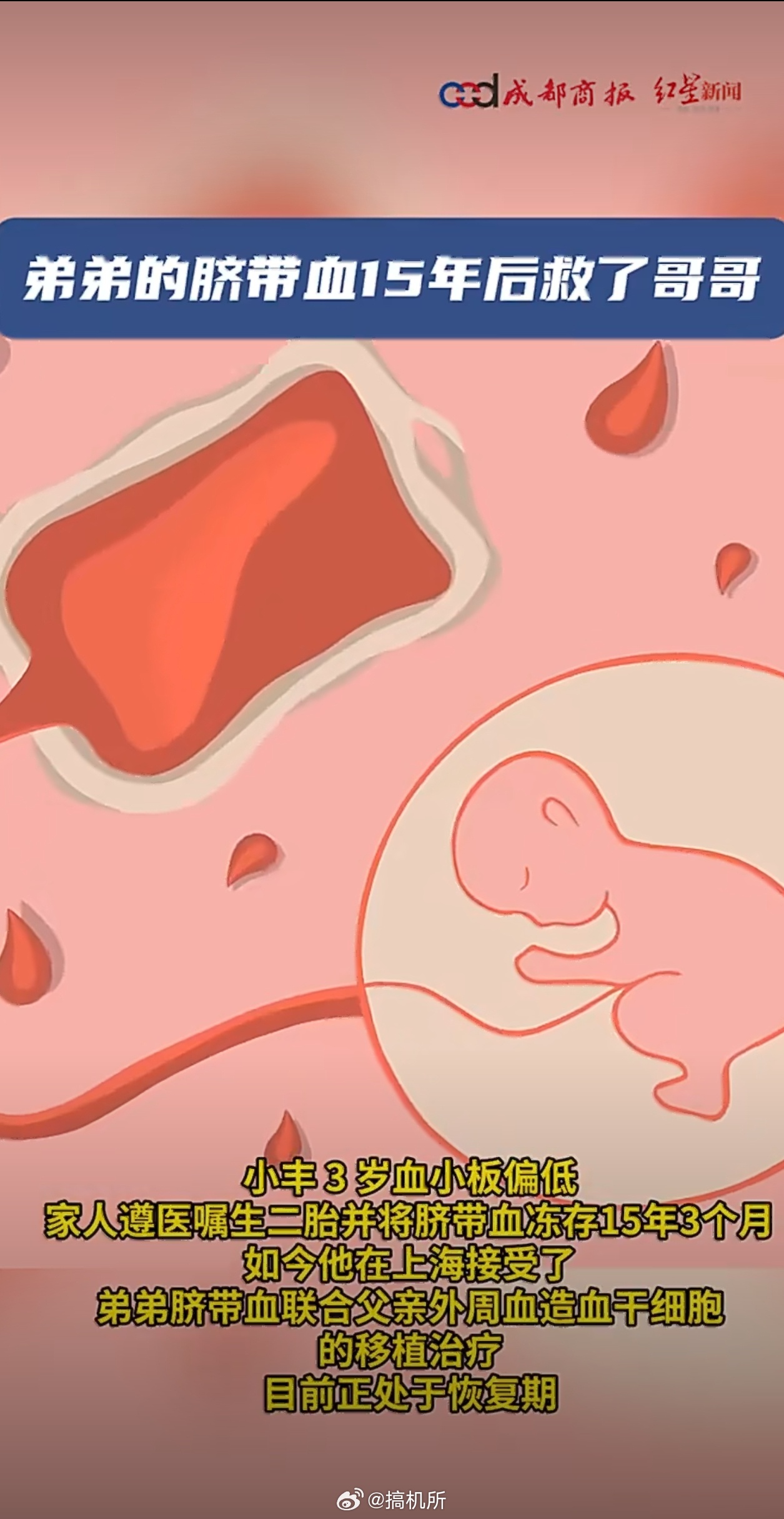 弟弟的脐带血15年后救了哥哥有能力的还是建议存一下脐带血，不怕一万就怕万一