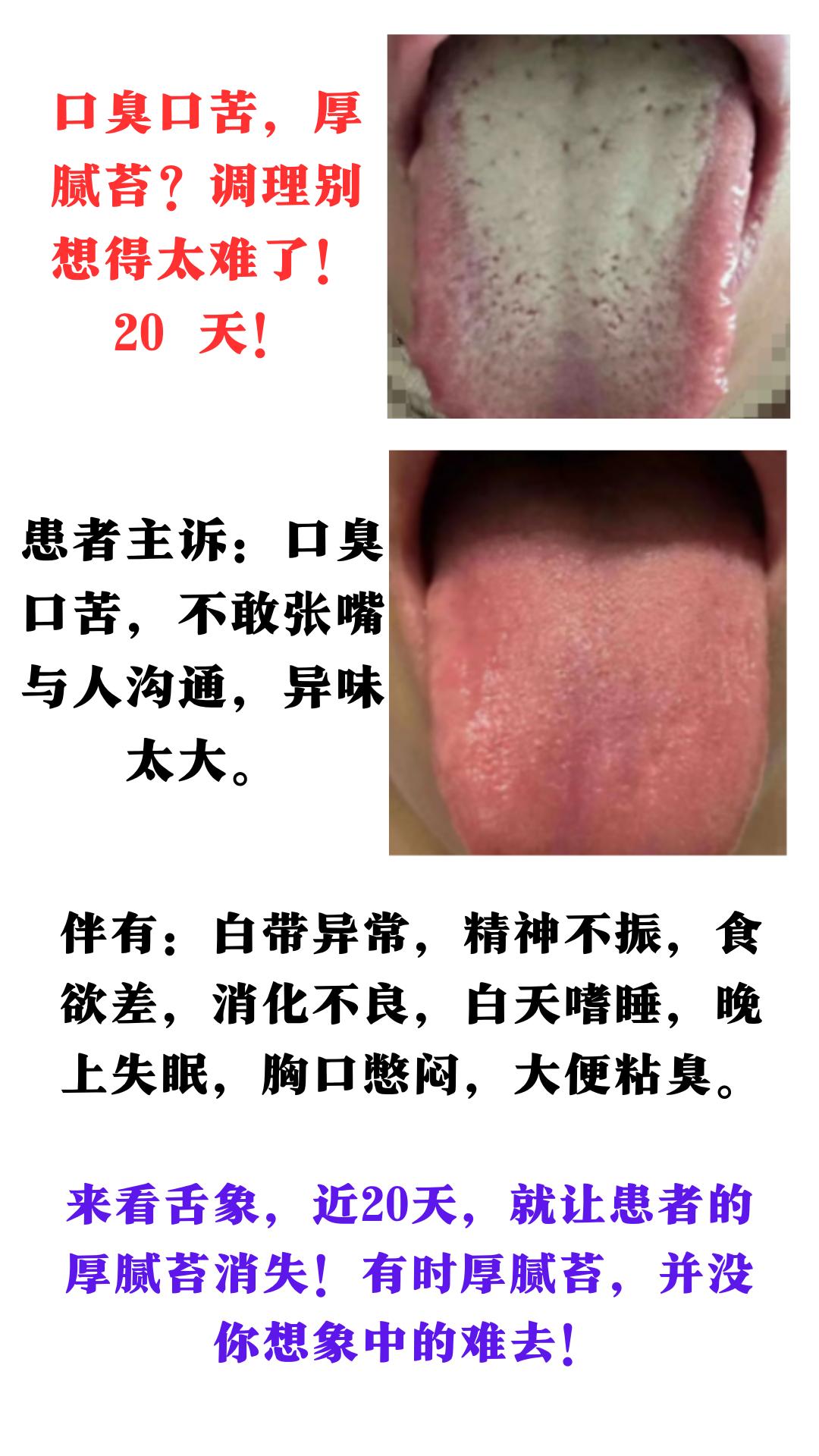 口臭口苦，厚腻苔？别想得太难了！#中医##中药##健康科普##舌诊#