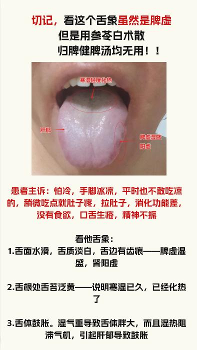 舌象分析