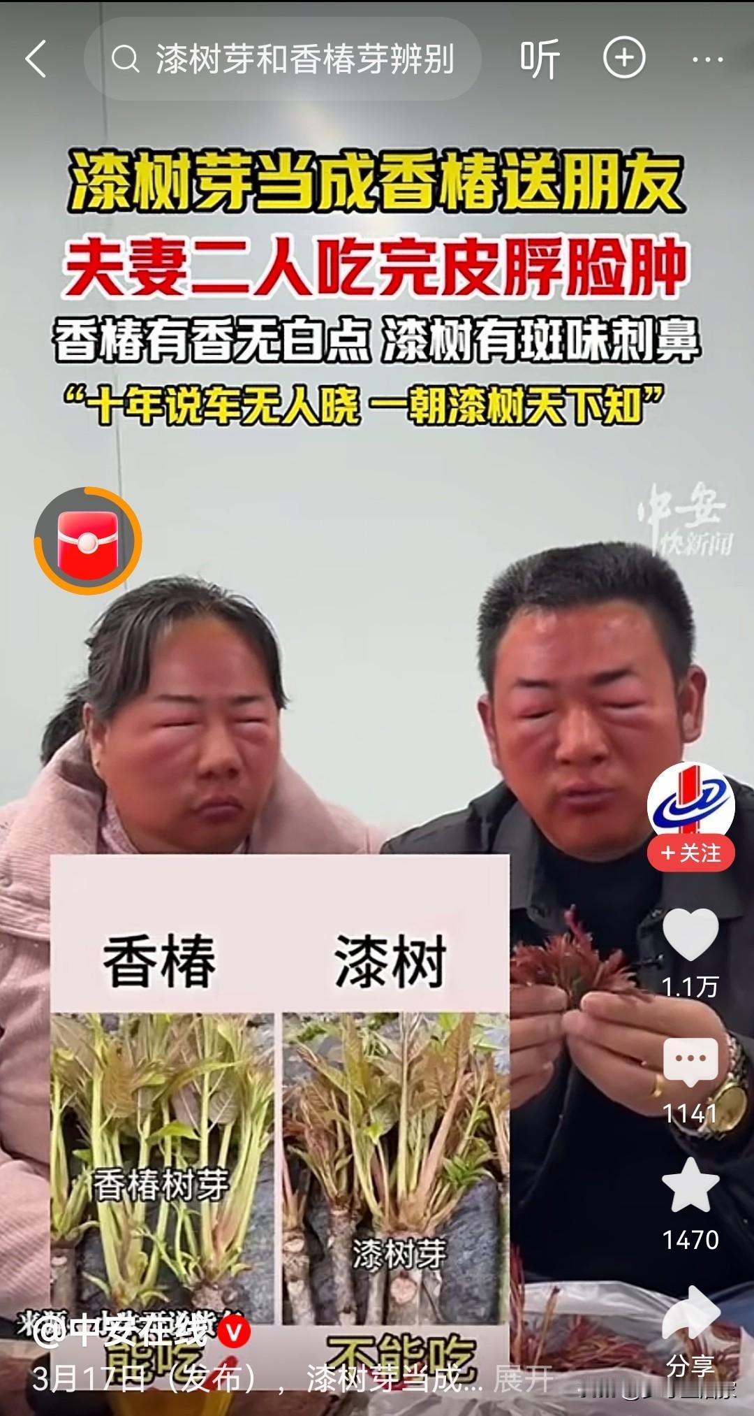 又到了吃香椿的季节，但是今年中招漆树叶的人也不少了，就像这对夫妻，吃完漆树叶过敏