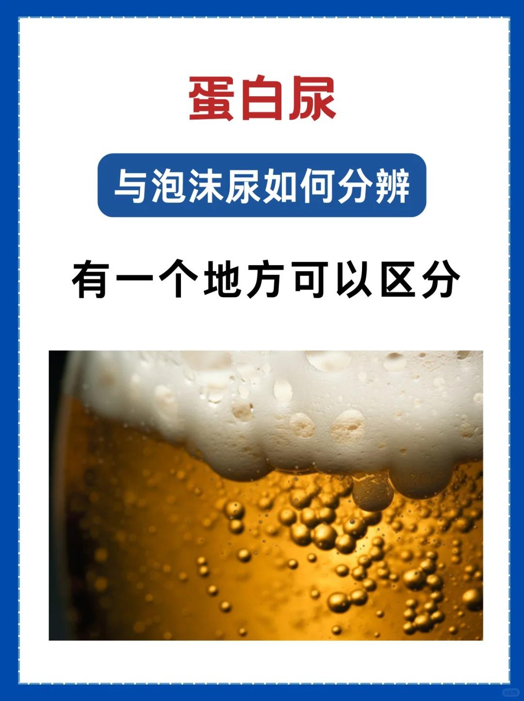 蛋白尿与泡沫尿如何区分？