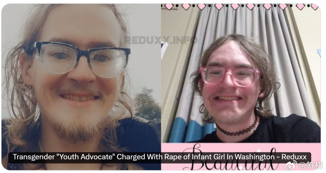 美国华盛顿州塔科马市一名跨性别者因涉嫌强奸一名6个月大的女婴被逮捕，它曾是当地青
