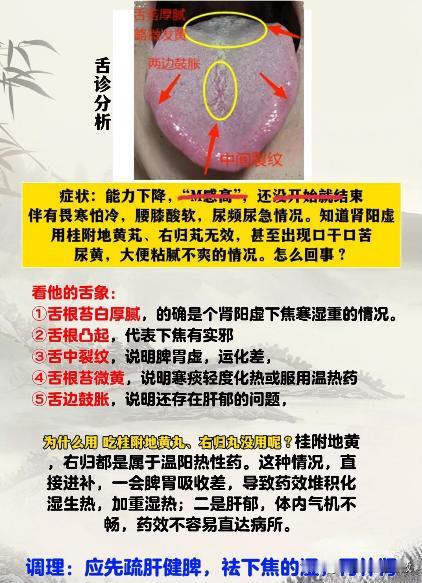 男科门诊最常见的4大舌象，一舌一诊[吃瓜群众][吃瓜群众][吃瓜群众]
一分钟教