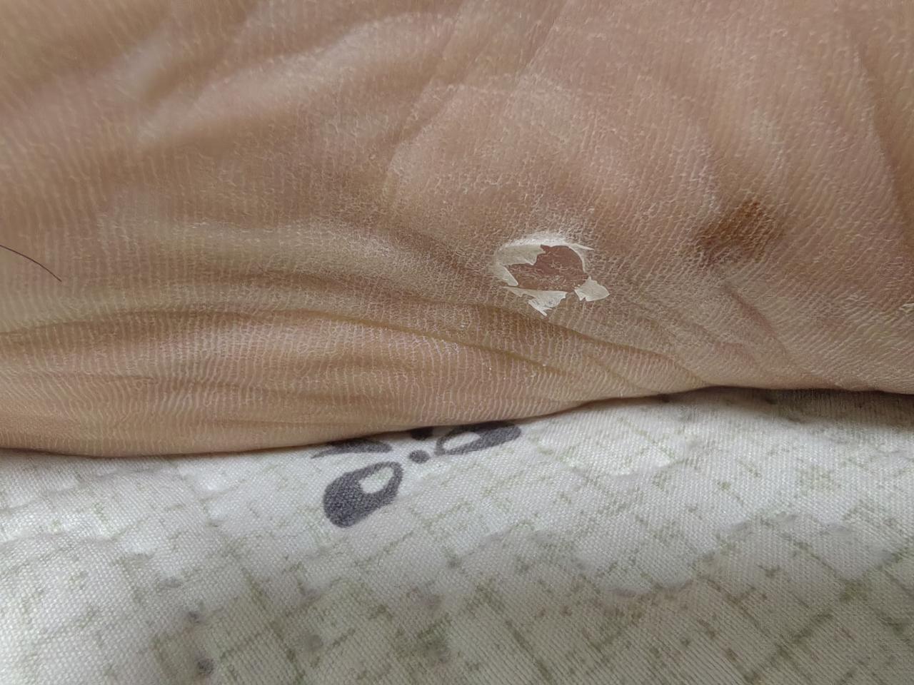 大半夜，感觉上次去长征医院看的脚心哪里不对劲。赶紧打开灯看看。[呲牙][呲牙]大