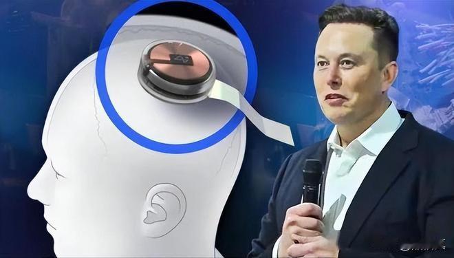 马斯克以后有可能掌控全球。

当他的脑机接口技术成熟，很多人都会植入芯片，有些不