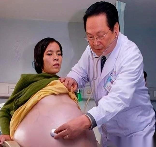 55公斤。
一个成年女性的体重，就这么硬生生从一个女人的肚子里取了出来。
你以为