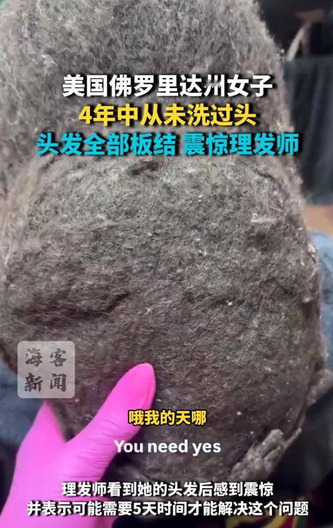 “真是活久见！”8月4日报道，美国，一女子超过4年没洗头，她的头发完全粘连成一片