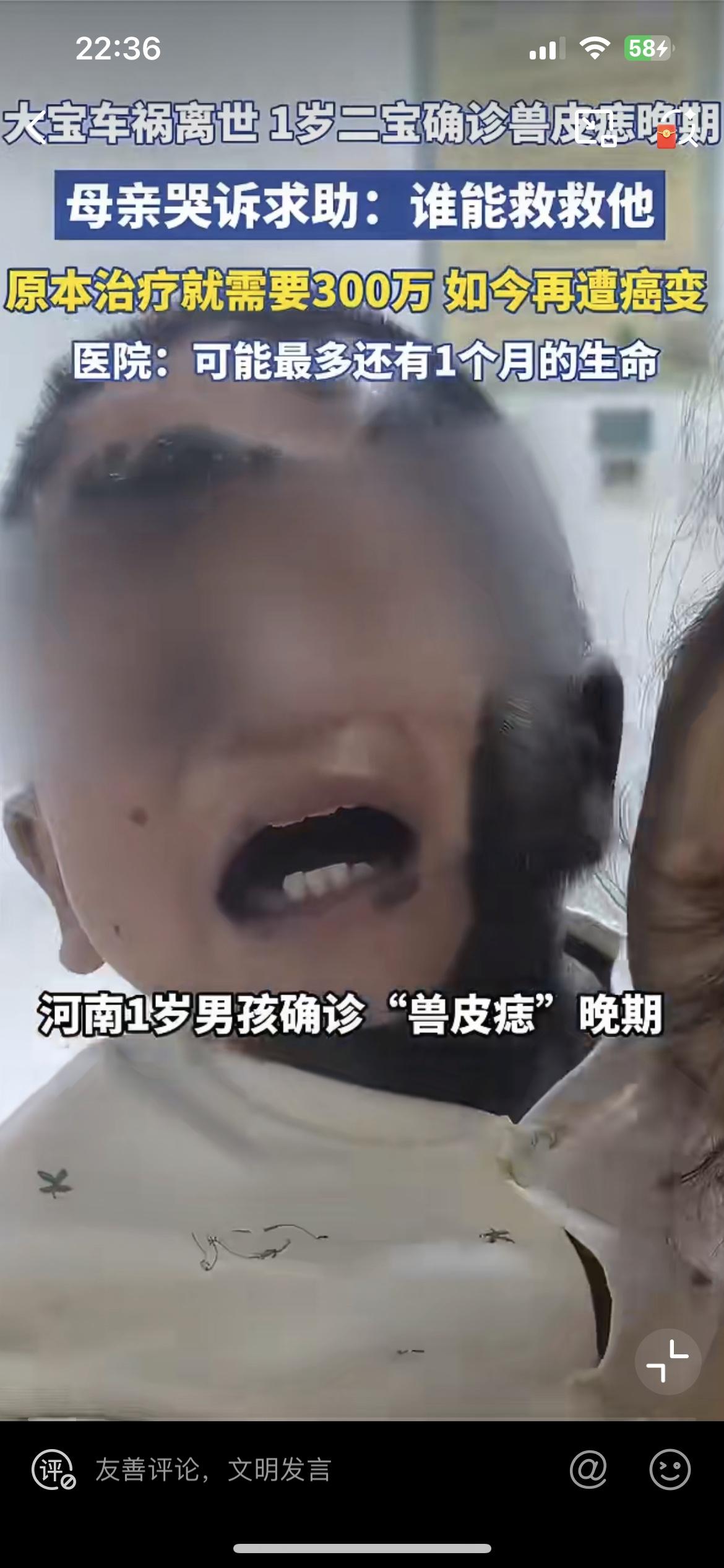 河南这个苦命的家庭，才一岁的孩子得了兽皮痣，如今已经癌变。6 岁的大宝因车祸去世