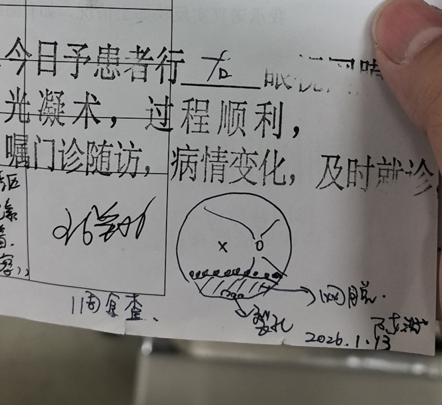 本来下定决心准备做近视手术的结果来医院检查出了视网膜局部脱落 告别近视手术了，估