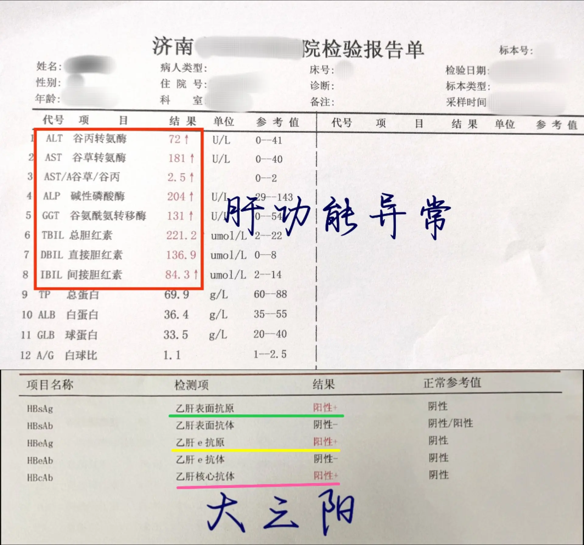 一位泰安肝癌患者，乙肝大三阳30多年，不痛不痒，觉得没啥大事，不管这个...