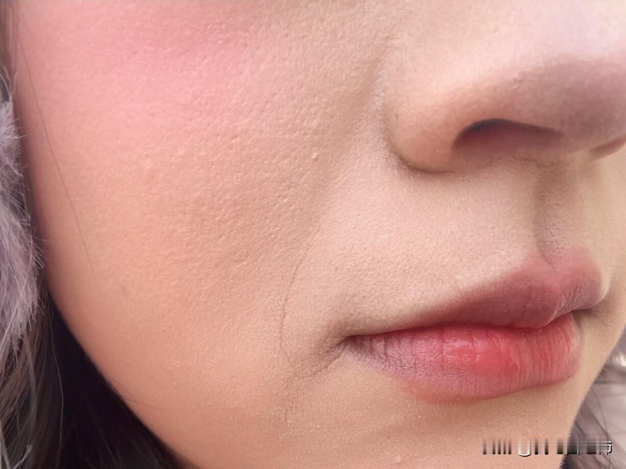 法令纹咋办！天塌了
我才21岁，但是就是法令纹很重，加上我平常不注意表情管理，很