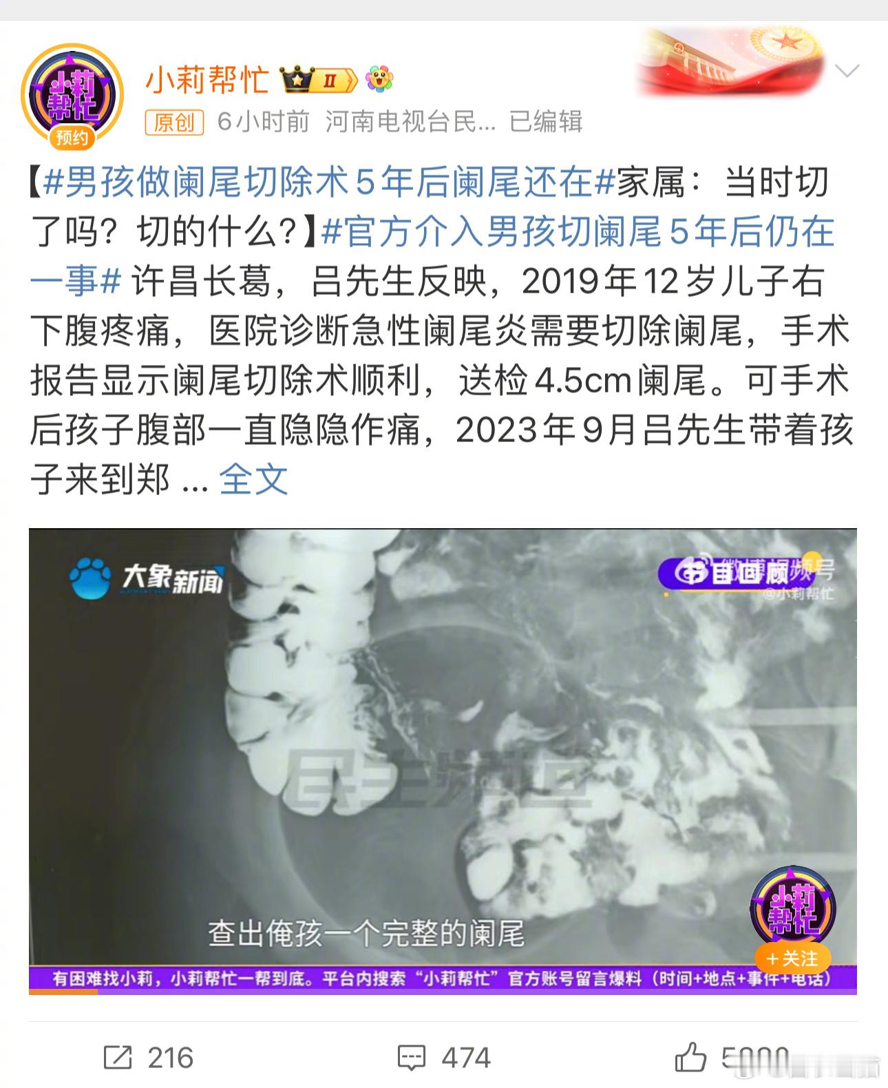 #男孩做阑尾切除术5年后阑尾还在#记得我刚刚大学毕业的时候，我读过一本专著《阑尾