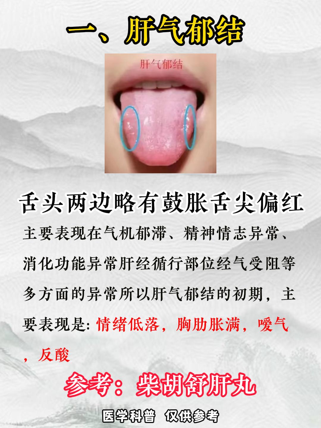 肝郁用逍遥丸没用？分清发展阶段最重要！
 
阶段①：肝气郁结——柴胡疏肝
阶段②