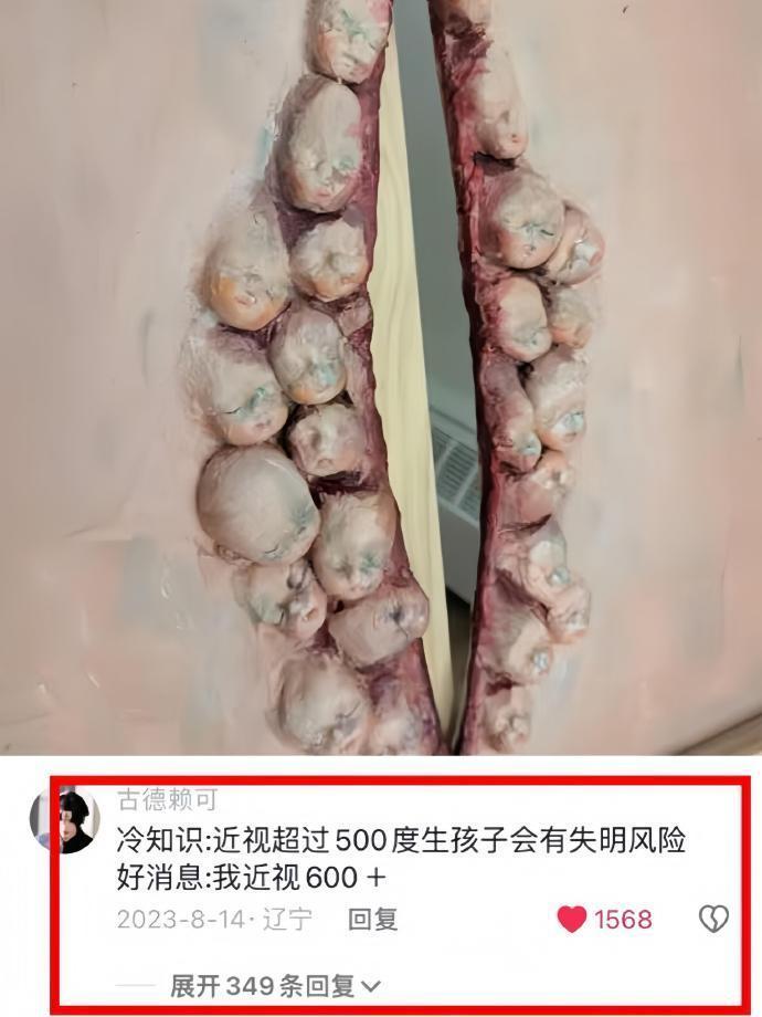 卧槽...瞬间对生育真相汗毛起立。。。 ​​​
