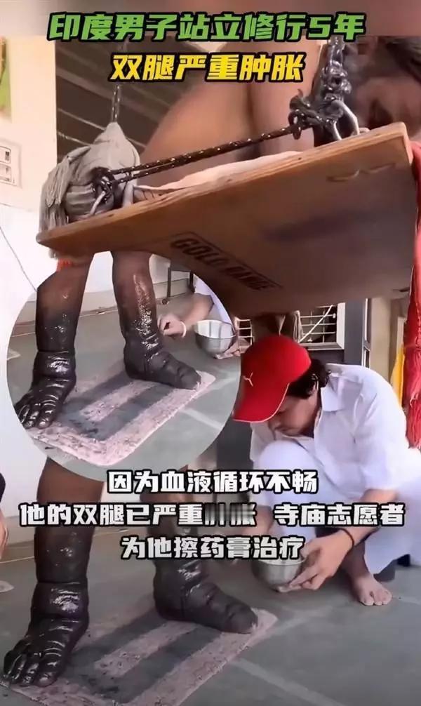 印度苦行僧站立五年，从来不坐着，也不躺着，导至双腿发黑。的行为真的超级离谱。有的