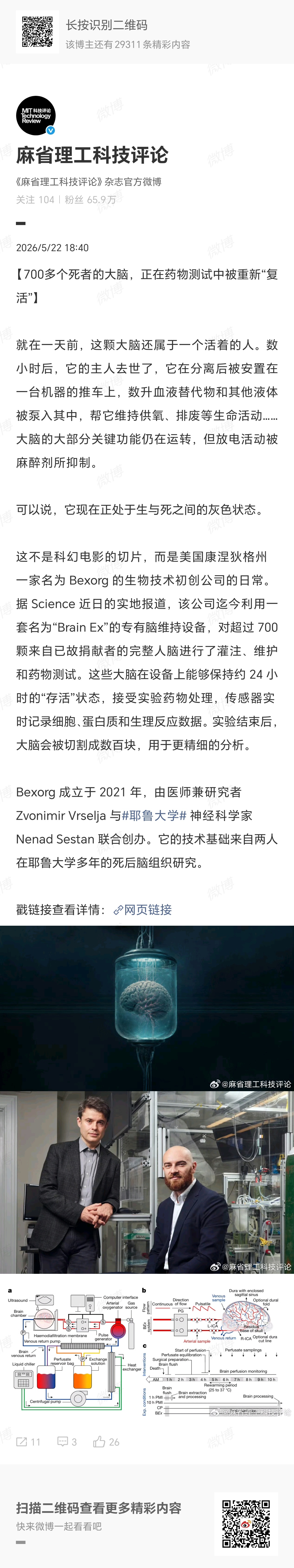 这不就是摘美国人的大脑吗，不是美国不知道得被喷成什么样 