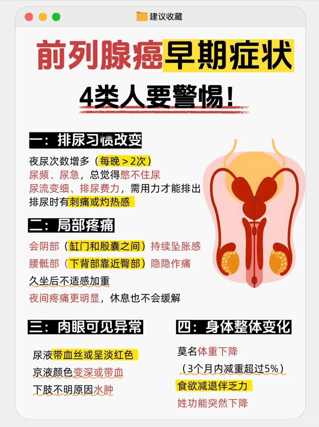 前列腺癌早期症状有哪些？这4类人要注意了！