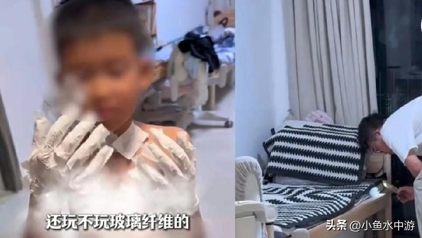 近日，中国广东一名男孩在家玩灭火毯时，脸部、颈部及双腿被玻璃纤维覆盖，难以去除。