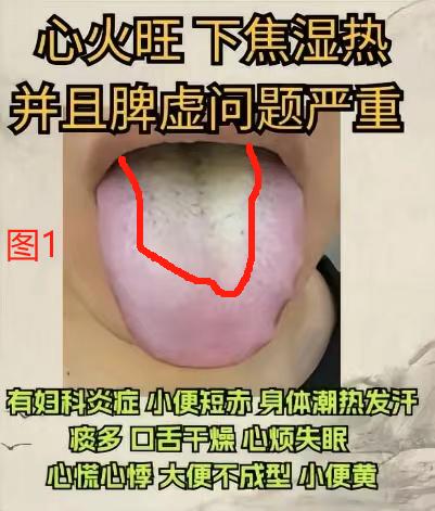 潘大夫每天能帮粉丝看多少个舌象？
今天一口气多看几个！挑战66个！多为大家排忧解