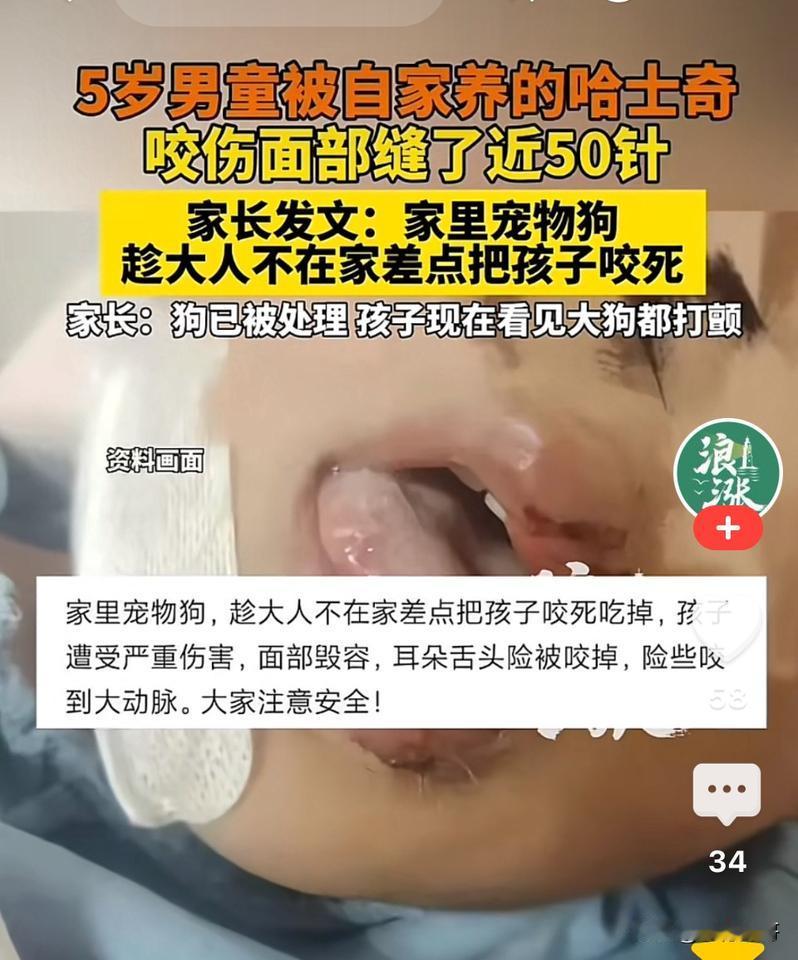 太可怕啦！江苏徐州，5岁男孩独自喂家养多年哈士奇零食，可就在孩子蹲下身体时被狗扑