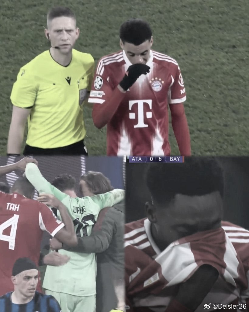 🚨🚨🚨亞特蘭大1-6拜仁慕尼黑賽後，馬克斯·埃貝爾：“賈馬爾·穆西亞拉的傷