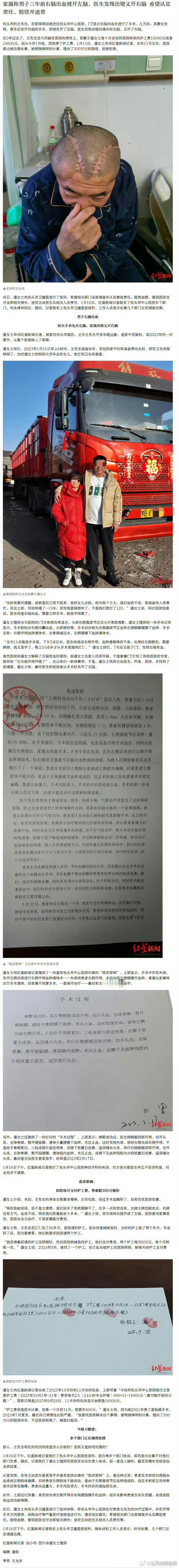 男子右脑出血被医生错开左脑 “世界就是一个巨大的草台班子”这句话的含金量还在提升