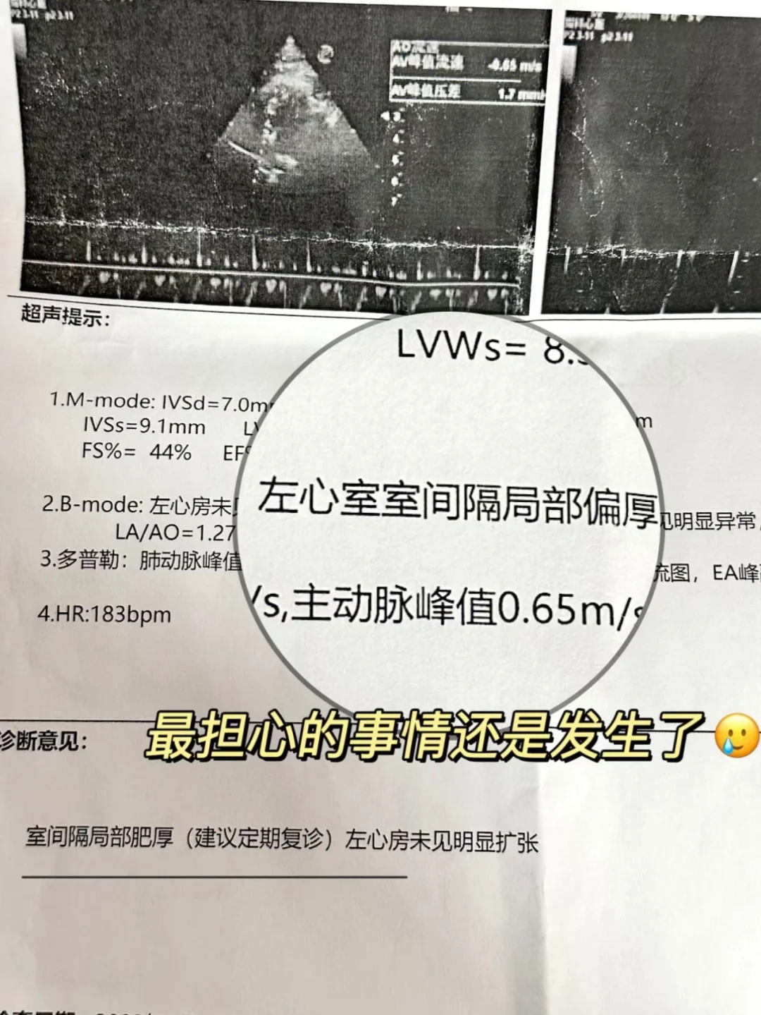 猫咪肥胖要警惕心脏问题❗不是越胖越好！