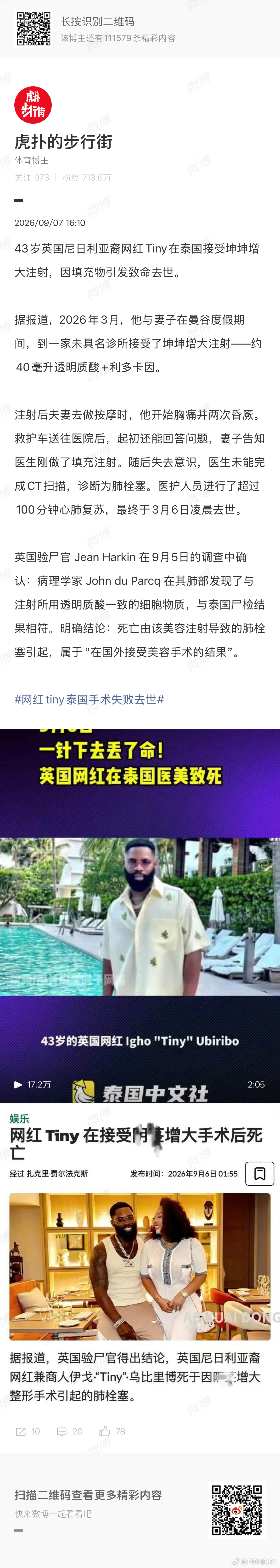 网红Tiny泰国手术失败去世 中午看到了这新闻，大哥在一个诊所，给丁丁打了好像是