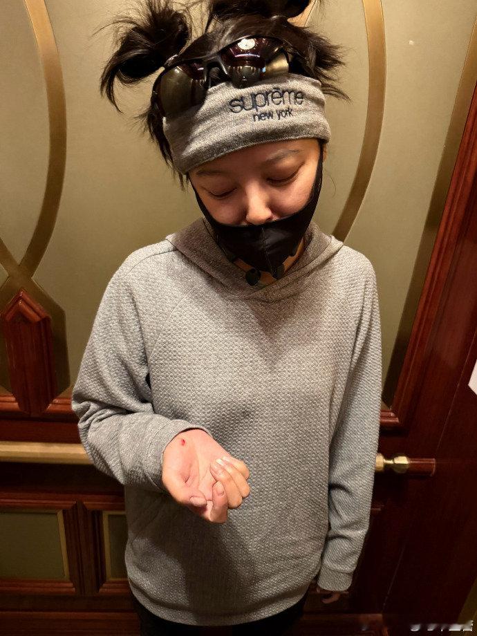 【辛芷蕾骑车摔了】辛芷蕾骑车扎了两个揪 5月9日，分享自己骑车摔了：“对～我又去