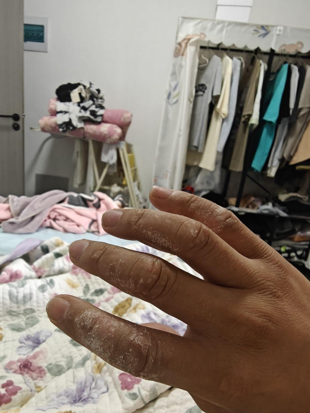 万能的皮友，这时候反反复复这样，有没有什么好一点的办法，可以解决这个问题