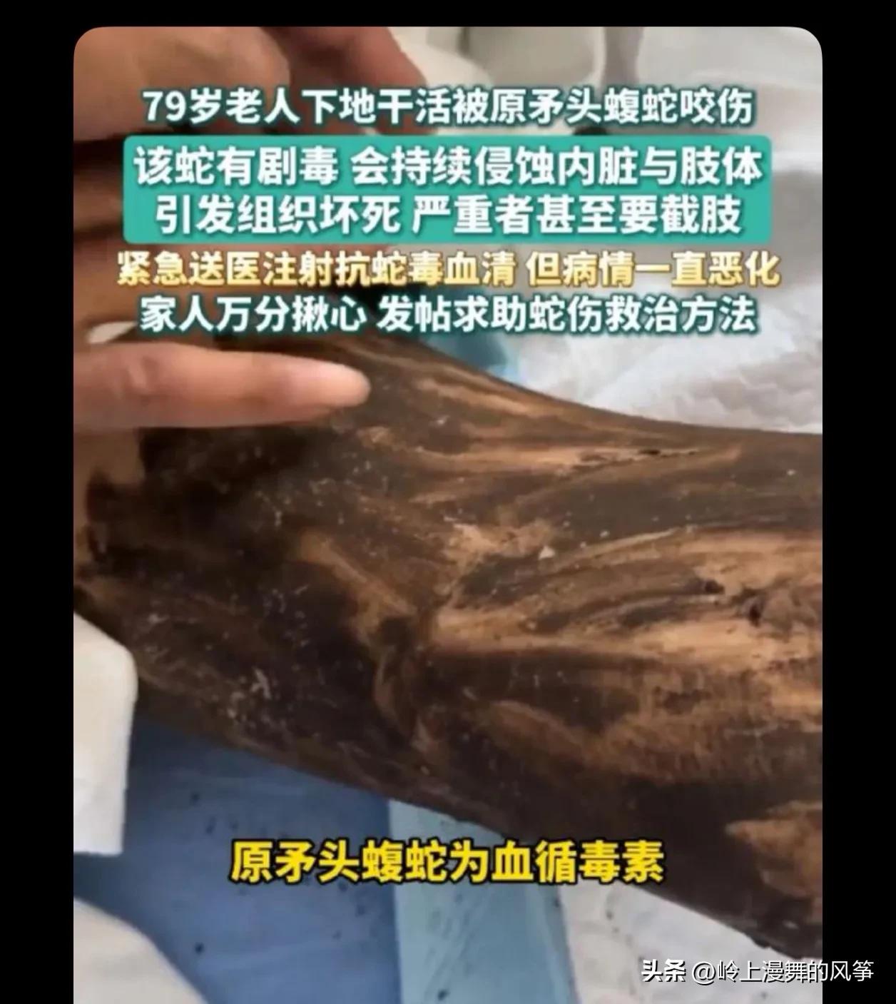 现在山里的蛇越来越多想想都害怕不敢出门，地摘菜也被蛇咬了，还好不严重，

比眼睛