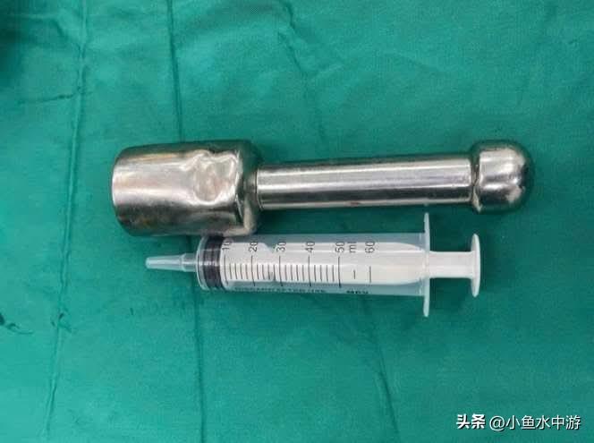 差点破裂！
15岁少年误将“18厘米金属异物”塞入直肠，医生惊呼：远超括约肌承受