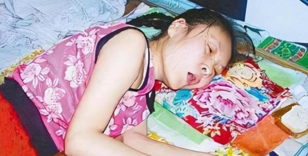 1987年，吴桂英跟哥哥发生口角，情急之下哥哥扇了她两巴掌，没曾想，吴桂英乘机装