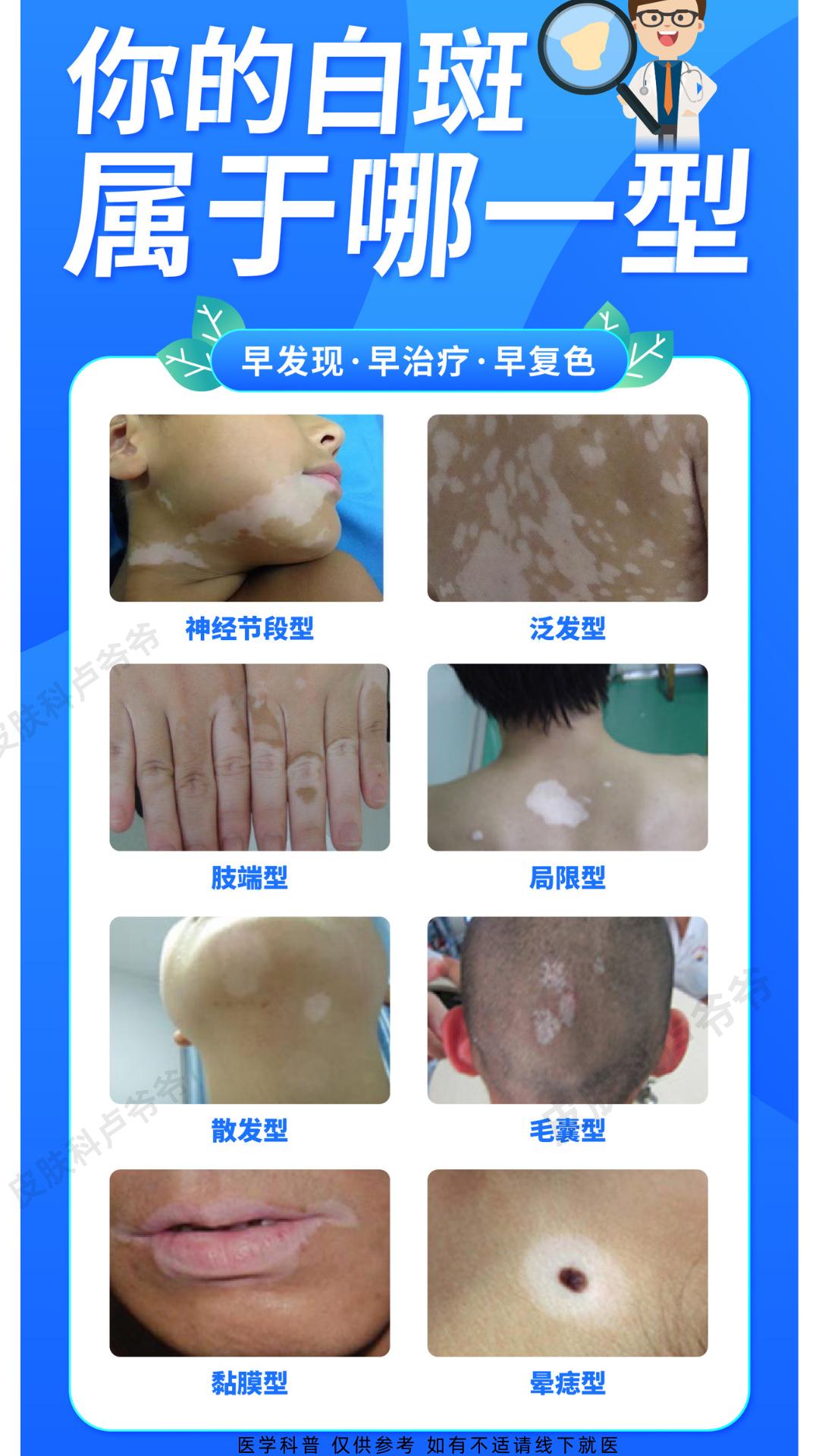 一图教你辨别白斑类型