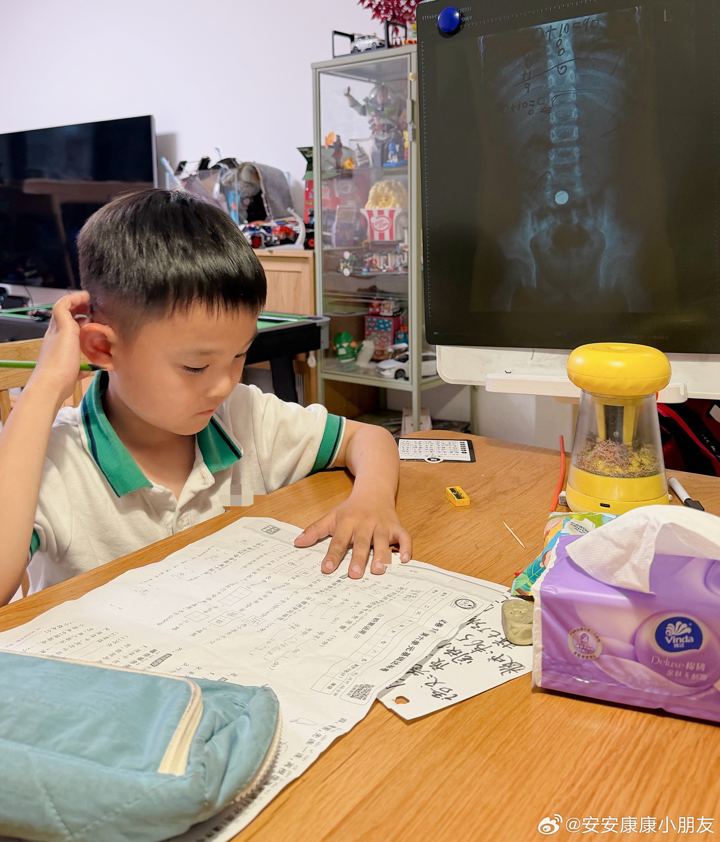 安康爸前几天摔得手臂还是疼，下班去趟医院顺便把康康的胶片拿回来了。一来警示不要乱