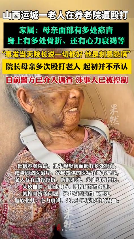 山西，凌晨三点左右，一位八旬老人在养老院遭院长的妈妈殴打到天亮，还威胁老人不让给