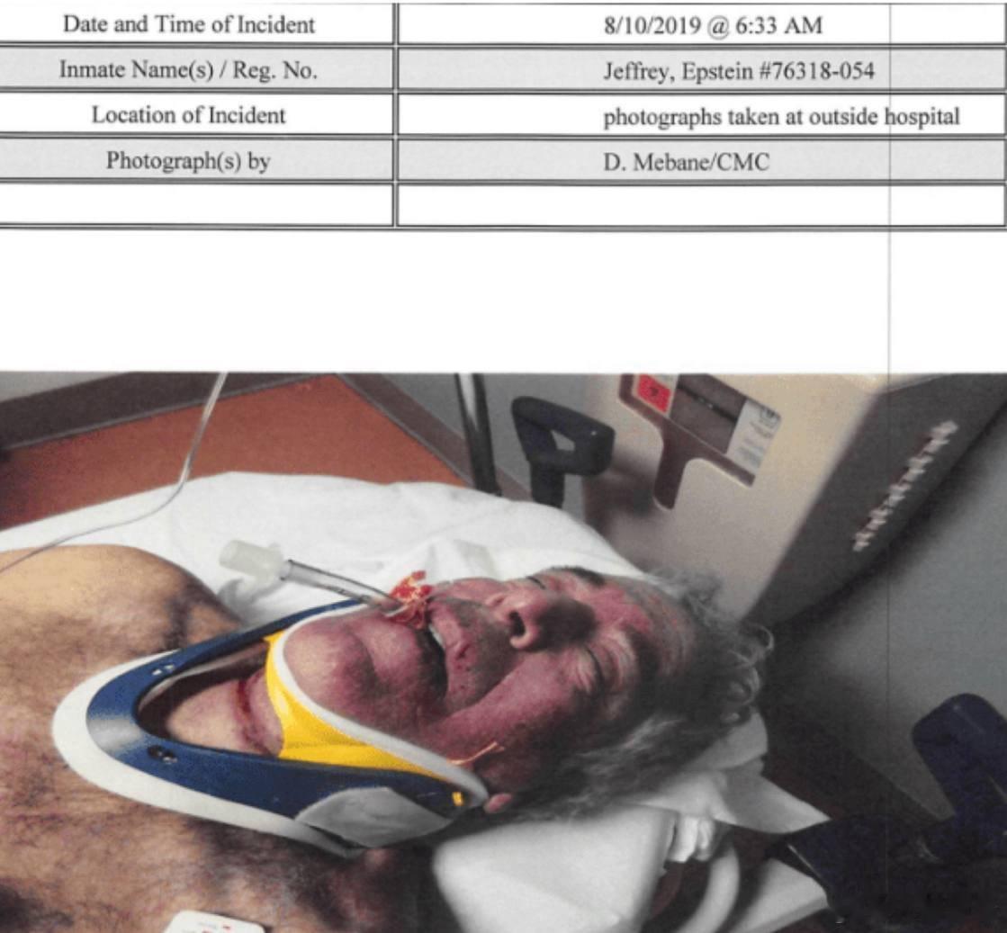 爱泼斯坦自缢后照片首度公开最新文件中更多爱泼斯坦死亡照片临床记录显示爱泼斯坦否认