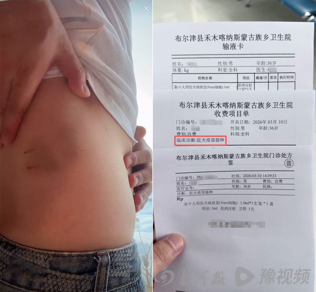 新疆阿勒泰咬人狐狸被滑雪场打死？知情人提供现场视频，林草部门已介入核查，该狐狸为赤狐属二级国保